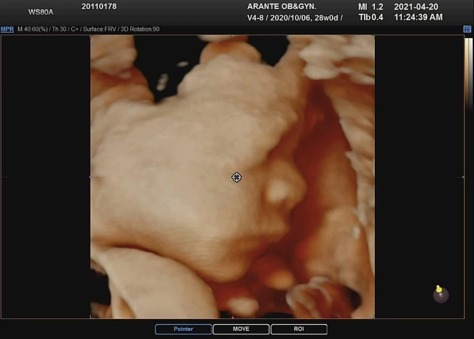 KakaoTalk_Photo_2021-04-25-22-18-28.jpeg?type=w1