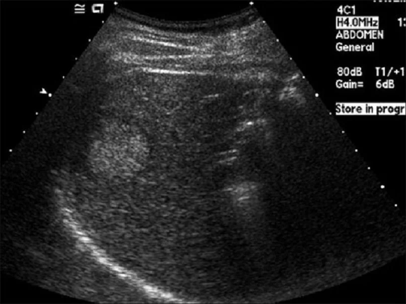 2009070701053_0.jpg?type=w1200