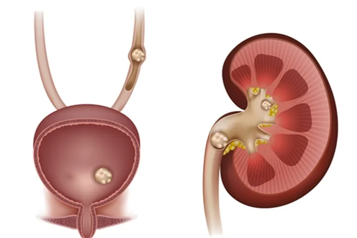 %EC%9A%94%EB%A1%9C.jpg?type=w1200