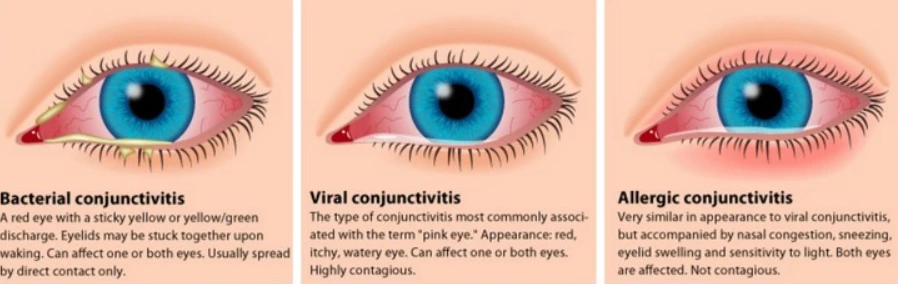 %EB%B8%94.png?type=w1200