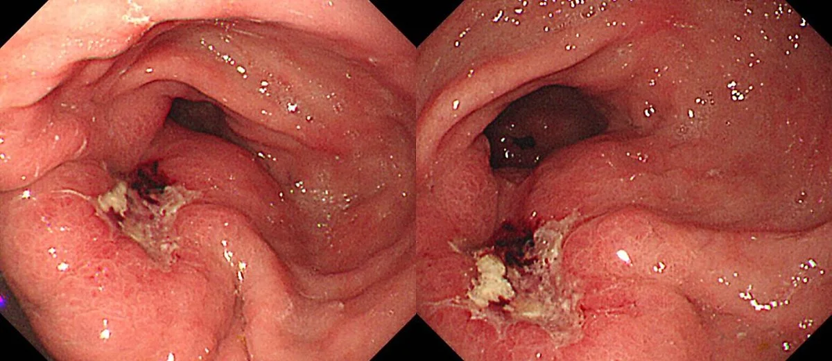 tube_01.jpg?type=w1200