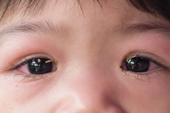 %E3%85%88%E3%84%B9.jpg?type=w1200