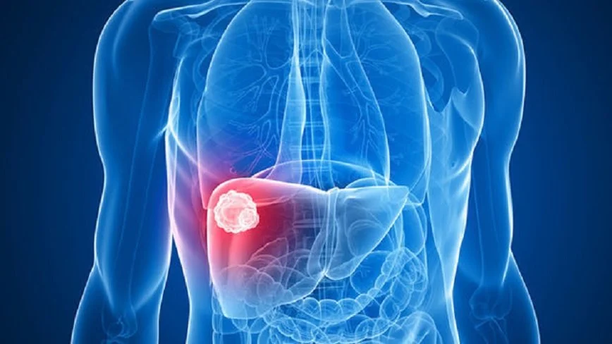 SDFSDFSDF.jpg?type=w1200