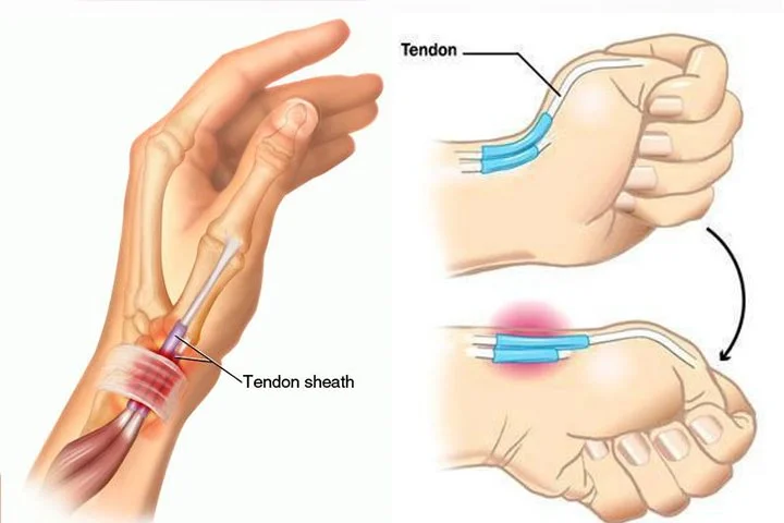 %E3%85%87.jpg?type=w1200