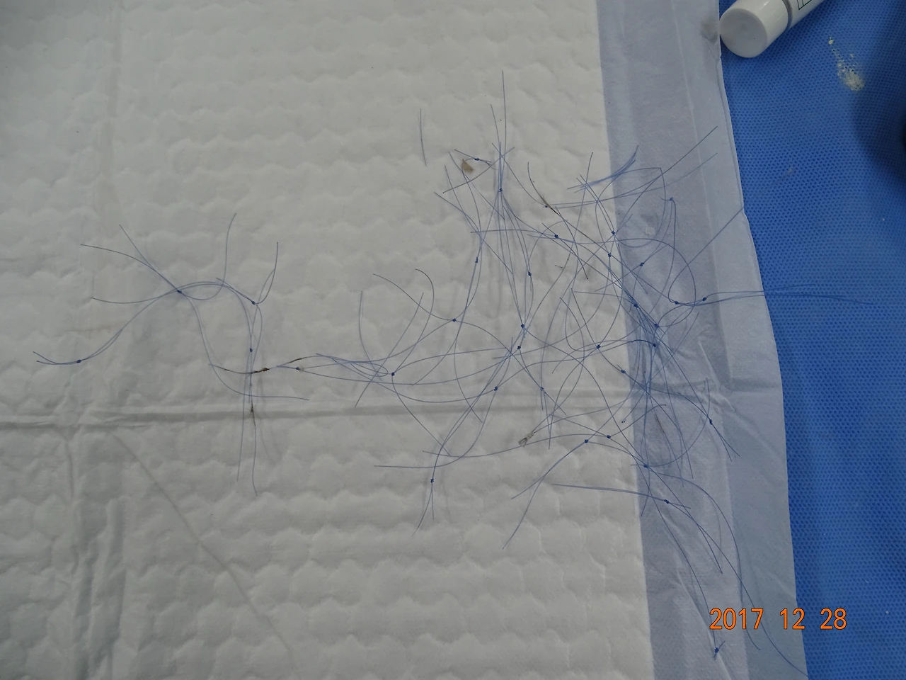 풀어낸 그물.JPG