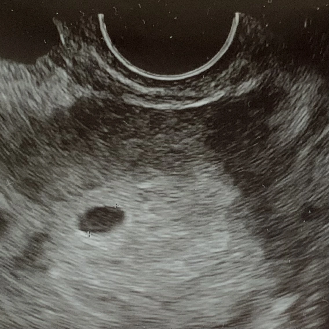 IMG_5238 복사본.heic