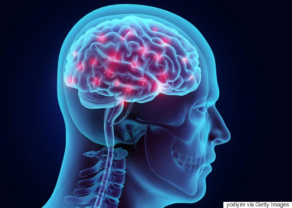 o-BRAIN-570.jpg?type=w1