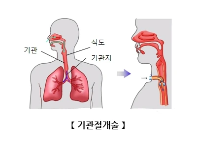 imageView.do?fileId=F000000039676_RIIkxU