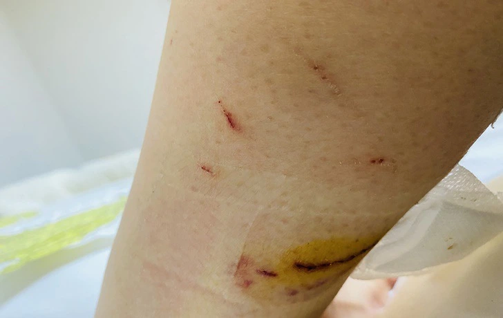 99CCD14C5F3E344B2FF0E7