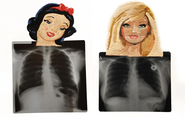 99FA8C455F5FE6590F2174