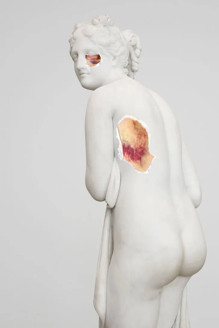 9995934A5F22C5CF1E303C