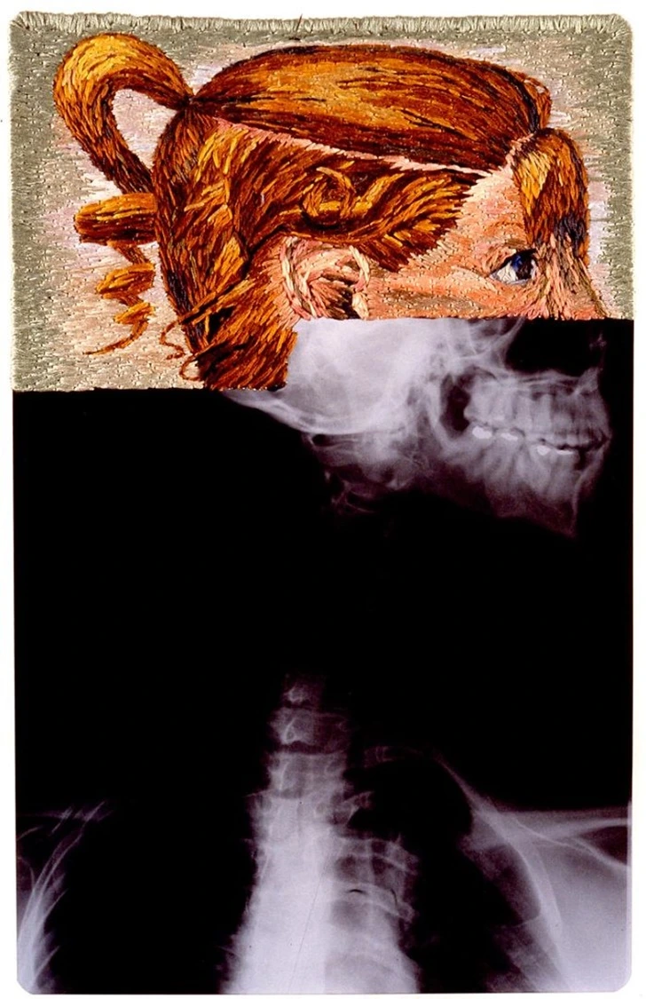 994CC9485F5FE6510FD621