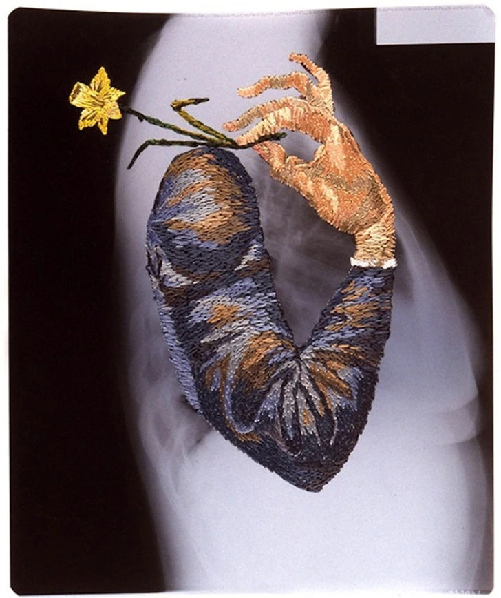 99D892505F5FE6510D09EB