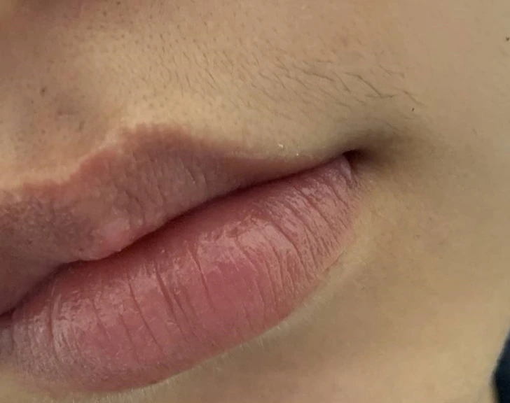 99D1A5495F7036BC2DE075