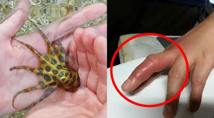 996E824F5D34988B31F814