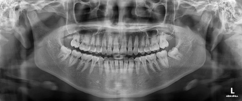 qv2blqj1u3s3lqw6hy5x5zs9h8ta