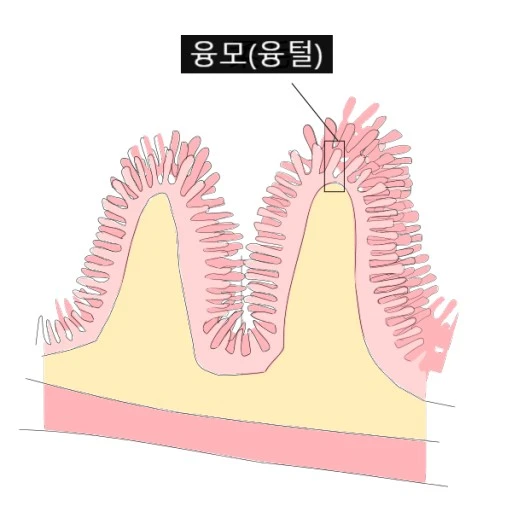 ?src=http%3A%2F%2Fblogfiles.naver.net%2FMjAxOTAyMjBfMzQg%2FMDAxNTUwNjUyNjg4MDky.hro8XGUZZTursKR-Gw-GPCFbqnZY4V7hw59Fdkq2F-0g.Drm1VHizlhxFDm7PasxI_byDdMOUJf8AkiycJmtX15Eg.PNG.8medical%2FSE-b33c7b50-3add-4786-90f5-1cba67b60ec1.png&type=sc960_832