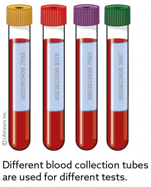 vacutainersupdated201702scaler.jpg?la=en&amp;hash=0AA71BD29D20D01D15FD362E7CA30A70