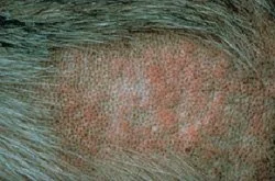 allergy_-_general-2.jpg?la=en&amp;hash=91176816C50C14A05EEDFECF4CDB9EF5