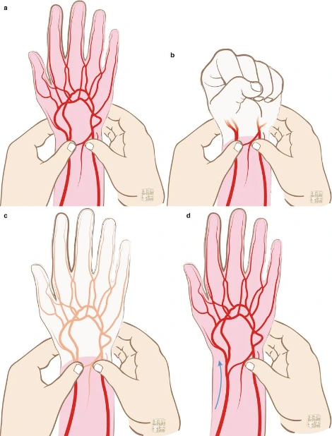 A327643_1_En_3_Fig2_HTML.gif?zoom=1.25&w=960