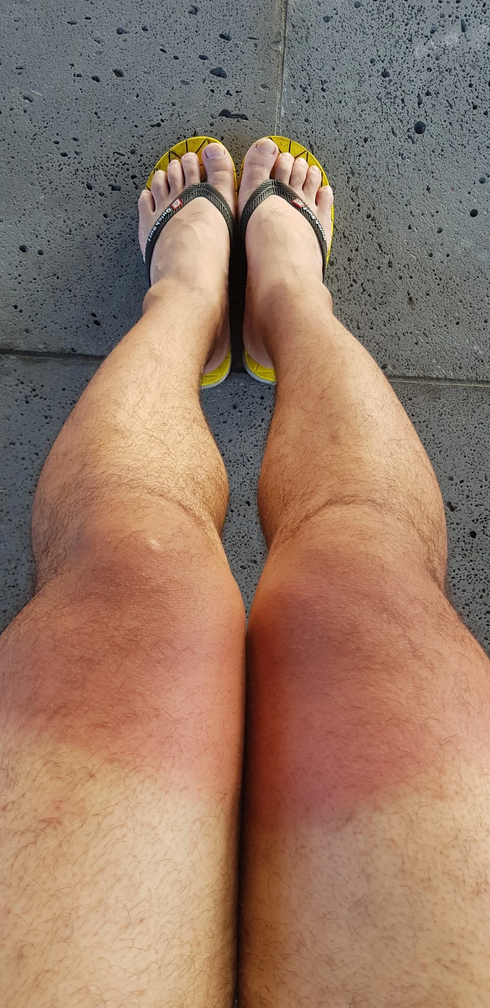 20180715_072557.jpg?type=w966