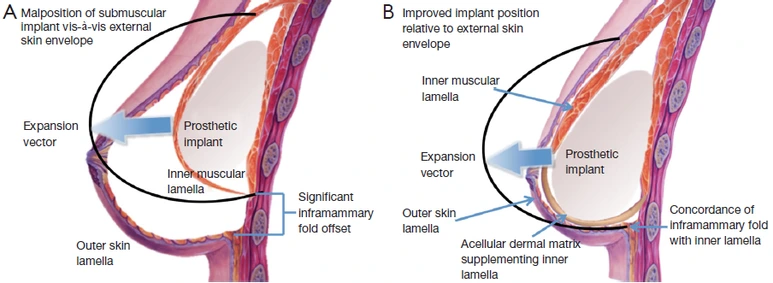 6564-PB3-R1.png?type=w773