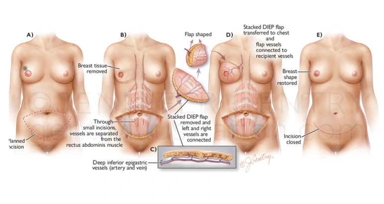 3366_257428.png?type=w773