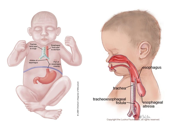 ea-tef-diagrams.jpg?ssl=1