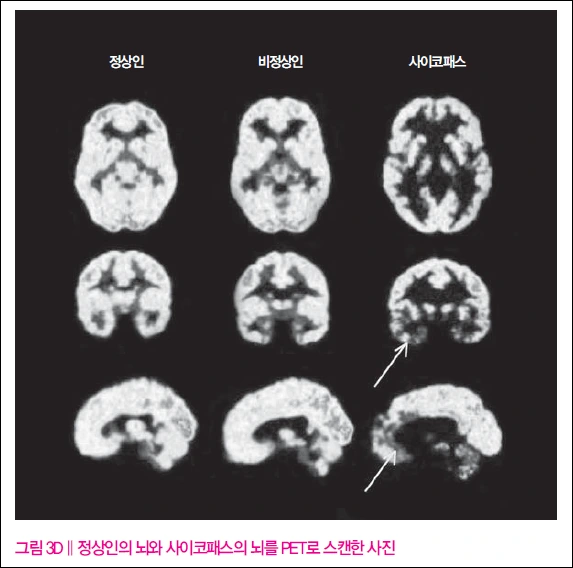 %EC%82%AC%EC%9D%B4%EC%BD%94%ED%8C%A8%EC%8A%A4_%EB%87%8C%EA%B3%BC%ED%95%99%EC%9E%90_4.png?type=w773