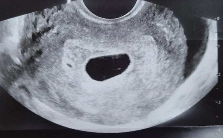 20240207%EF%BC%BF092552.jpg?type=w773