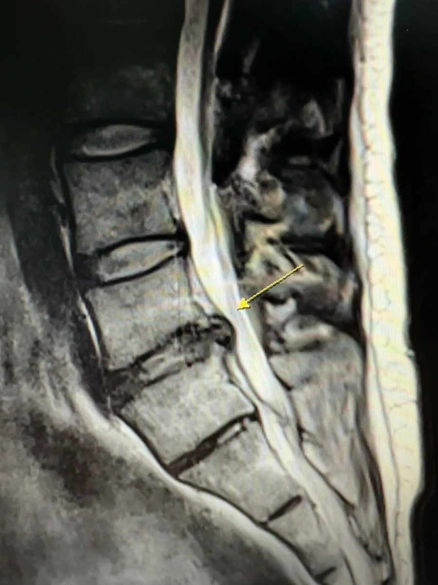 IMG_9264.jpg?type=w1