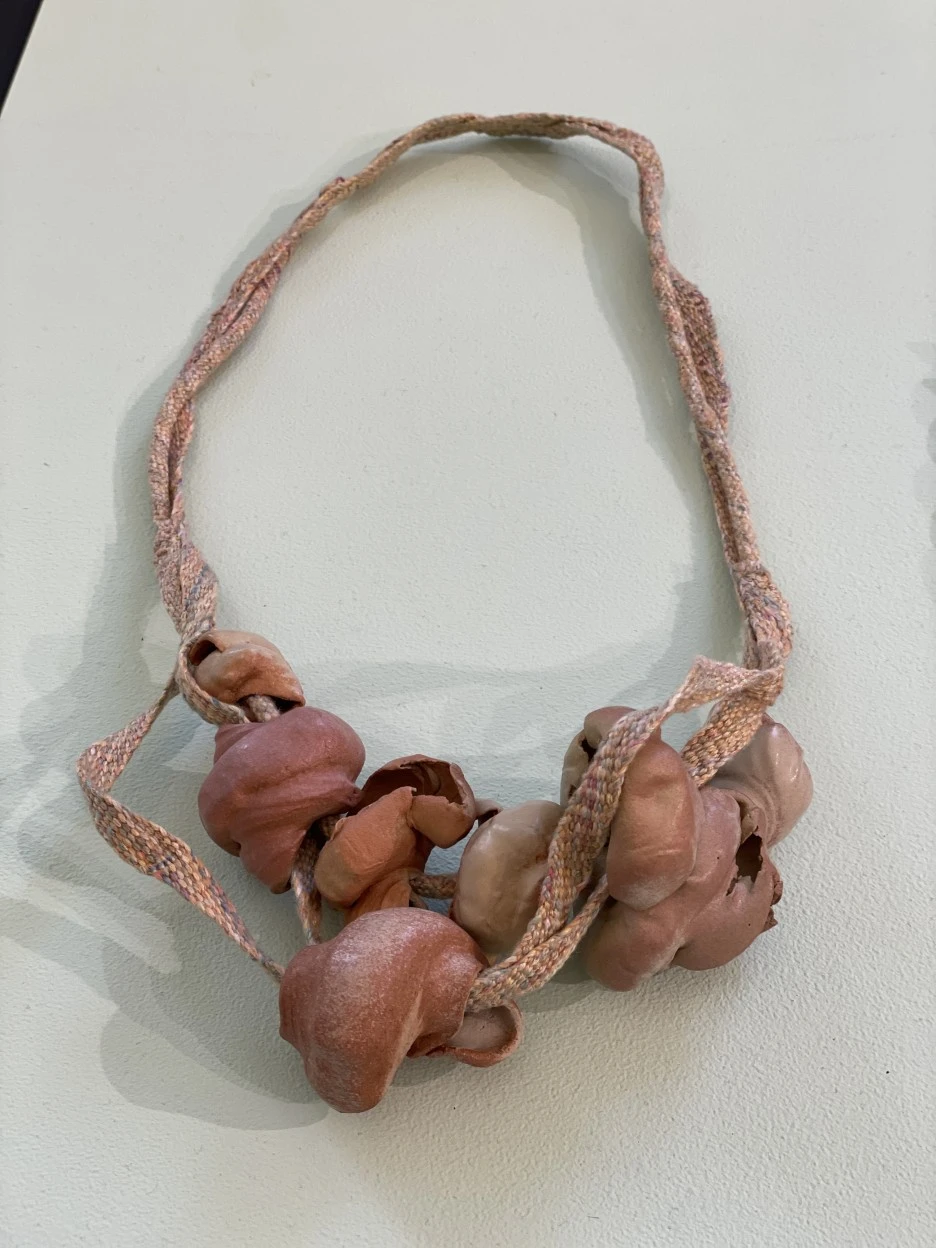 IMG_2848.JPG?type=w1