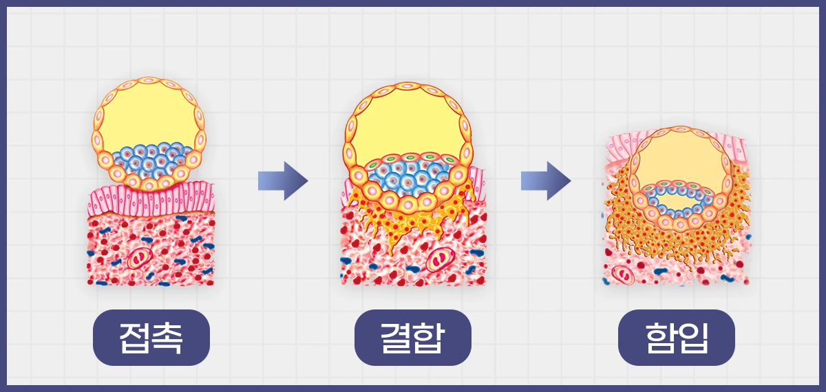 %EC%A0%91%EC%B4%89_%EA%B2%B0%ED%95%A9_%ED%95%A8%EC%9E%85.png?type=w1600