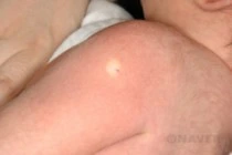 infant_0098_i3.jpg?type=w210_fst;;93;true