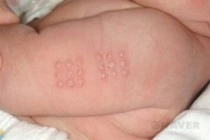 infant_0098_i1.jpg?type=w210_fst;;93;true