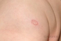 infant_0098_i2.jpg?type=w210_fst;;93;true