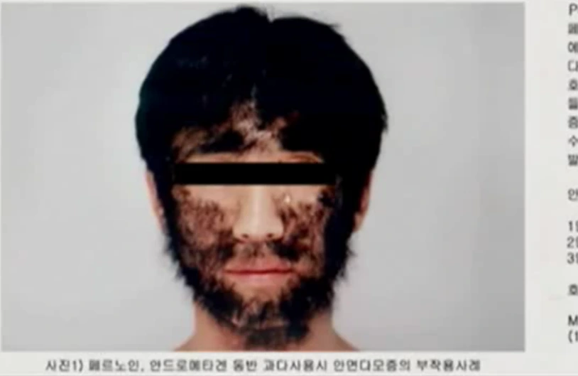 %EC%BA%A1%EC%B2%98.PNG?type=w1