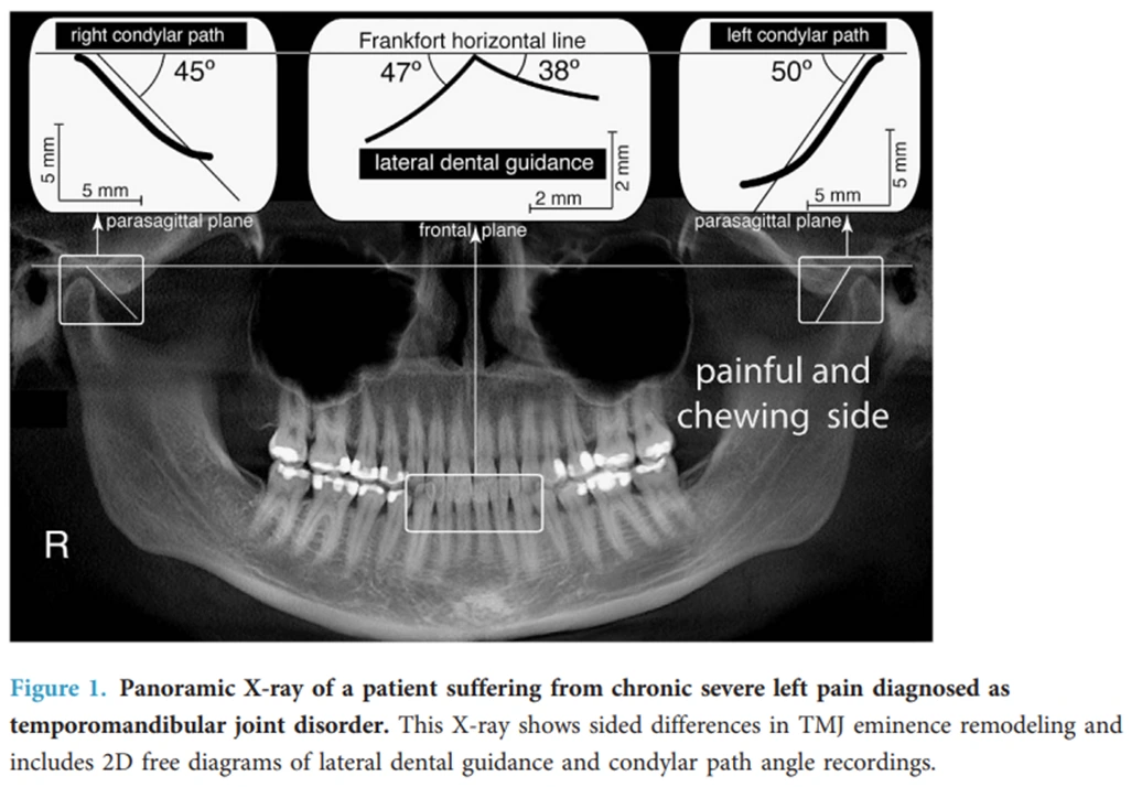 3Jff4D2K_f6Icp-awYQEDbepwuM