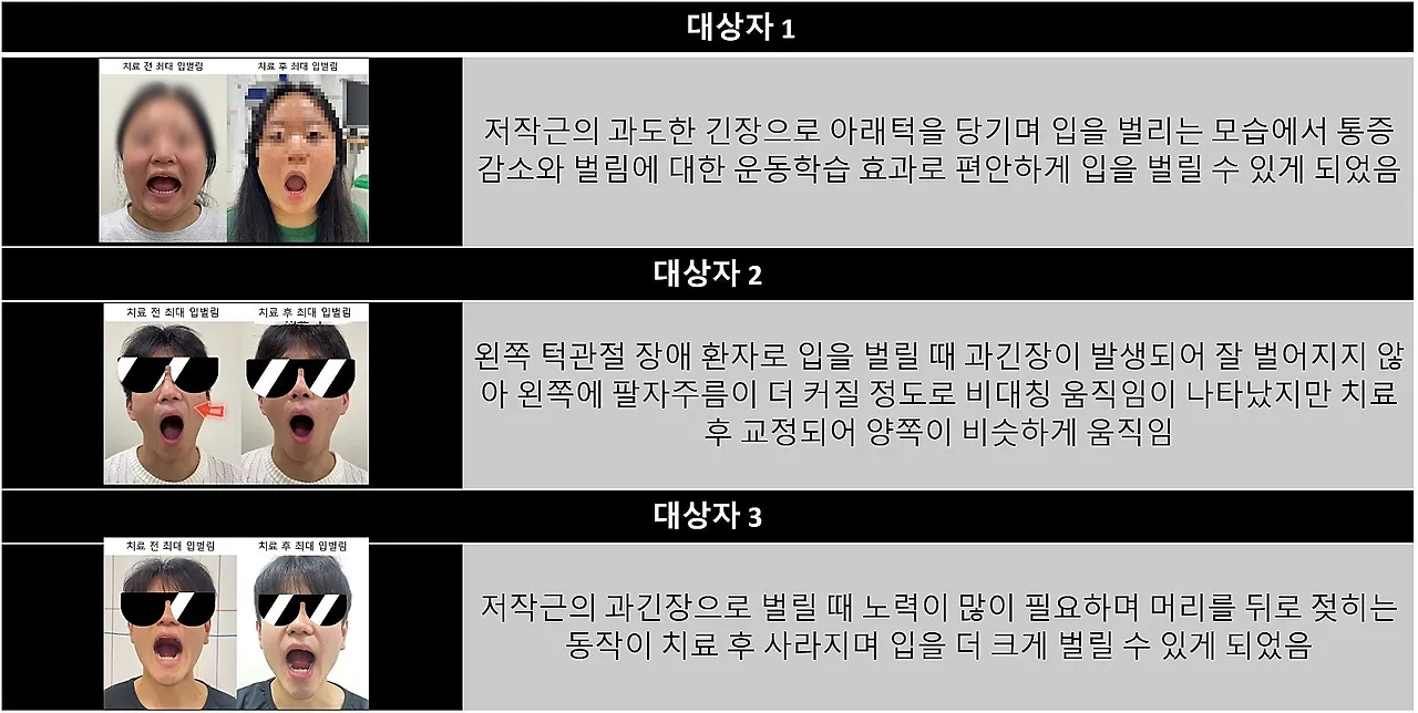 xdm044DQVwEH19uY-lf6fMXCzAs