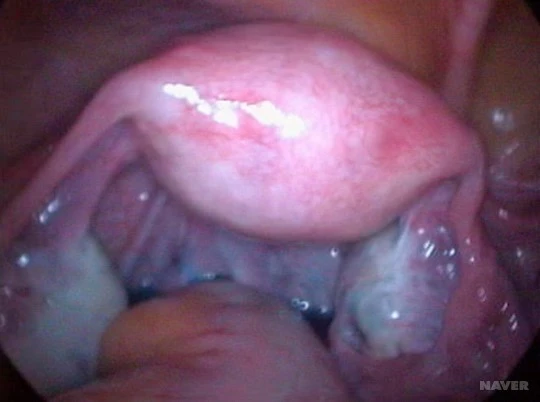 %25EB%2582%259C%25.jpg?type=w540_fst_n