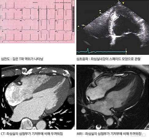 i1_AA000557_879.jpg?type=w530_fst_n&wm=Y