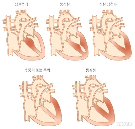 i1_AA000557_878.jpg?type=w530_fst_n&wm=Y