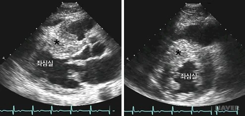 i1_AA000557_880.jpg?type=w530_fst_n&wm=Y