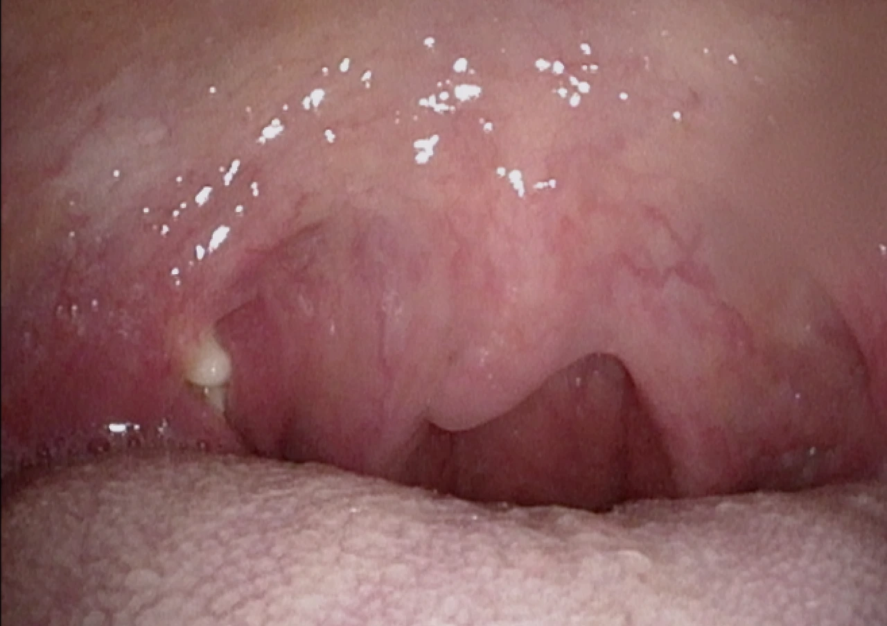 img.png?credential=yqXZFxpELC7KVnFOS48ylbz2pIh7yKj8&expires=1756652399&allow_ip=&allow_referer=&signature=TmvluAH%2FHy%2BvN4YBD%2FbcTtk9e%2BY%3D