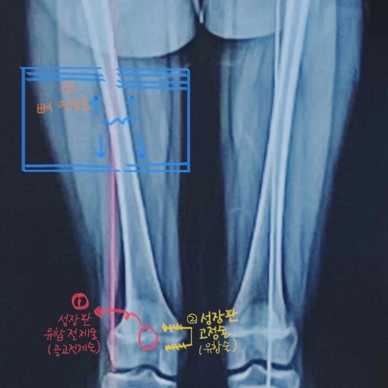 20230524%EF%BC%BF000443%EF%BC%BF379B58C9%EF%BC%8D158E%EF%BC%8D44B7%EF%BC%8D9E95%EF%BC%8D05B0BE1358E6.JPG?type=w773