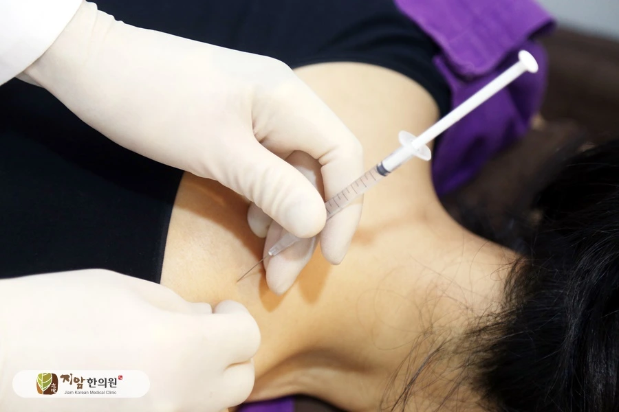 약침시술 (4).JPG