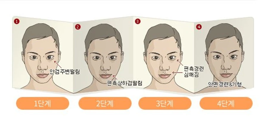 안면경련4단계치료.JPG