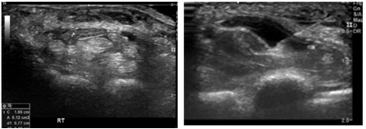 AD_4nXfJQ_QwlleyO0sinXZar2wyY3QNnJLaAHOr6Tyv3YZuN4hJ5UglSYg4l8b7IL6jXNwWaakzl2XJvbJfDSve6sOgChOhKImxoR7Jvbm17HP4MUV2OXclV_nn26vAat5D6ZMa-k0JwA?key=0_7uFam0xD727dkPNLVHRw