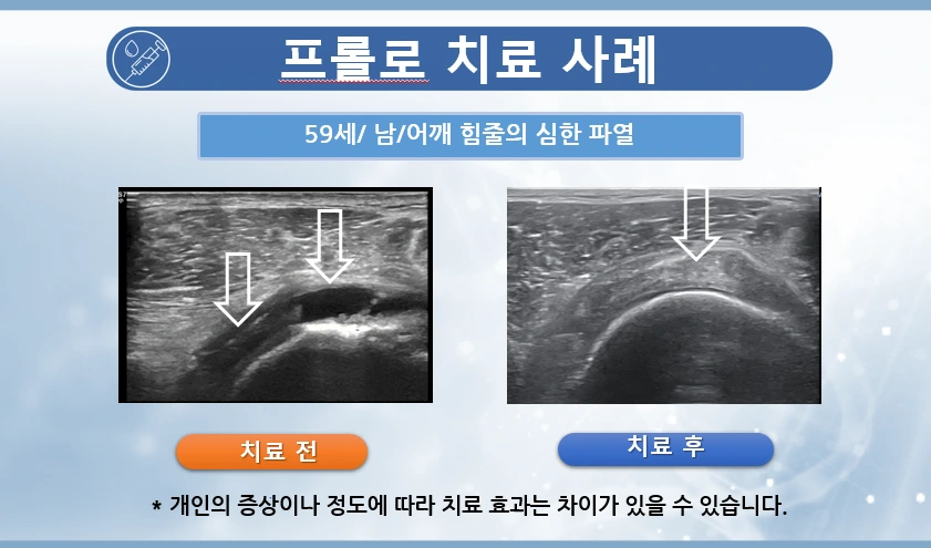 cSJ5IYWoIW6Nit59izOSBp3OQtfzPjSgBo10n0PCIEgtcSpUukfNB0_i-Rix_pgy6bJMkSZMAjXtmBHxdBDWDR6jV9o_mceJwF1o0qqJN83yzcNVM0tMU04GGrtfW89UdsmcD8N_rNFw37j-r5S574A