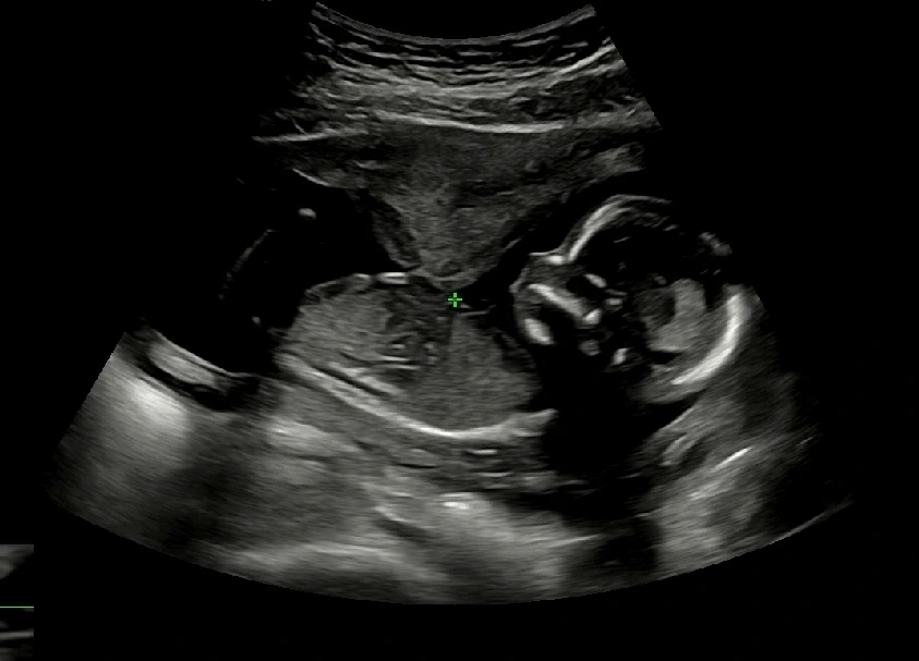 Screenshot_20230607_165821.jpg?type=w1